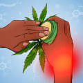 Is cbd good for nerve healing?