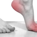 Does cbd help with neuropathy in feet?
