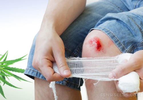 Does cbd speed up healing?